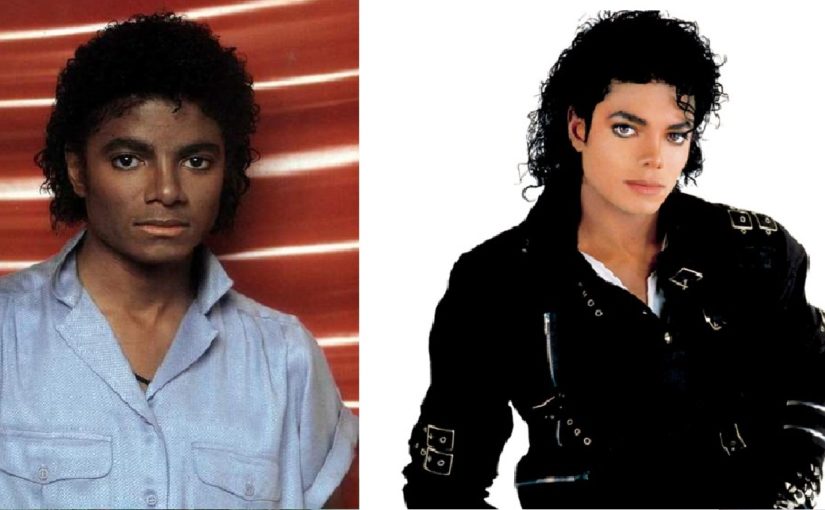 Dlaczego w miarę starzenia, skóra Michaela Jacksona stawała się coraz bielsza?