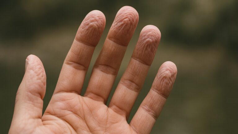 Dlaczego palce marszczą się w wodzie